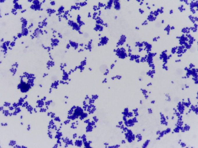 <p>What bacteria is this?</p>