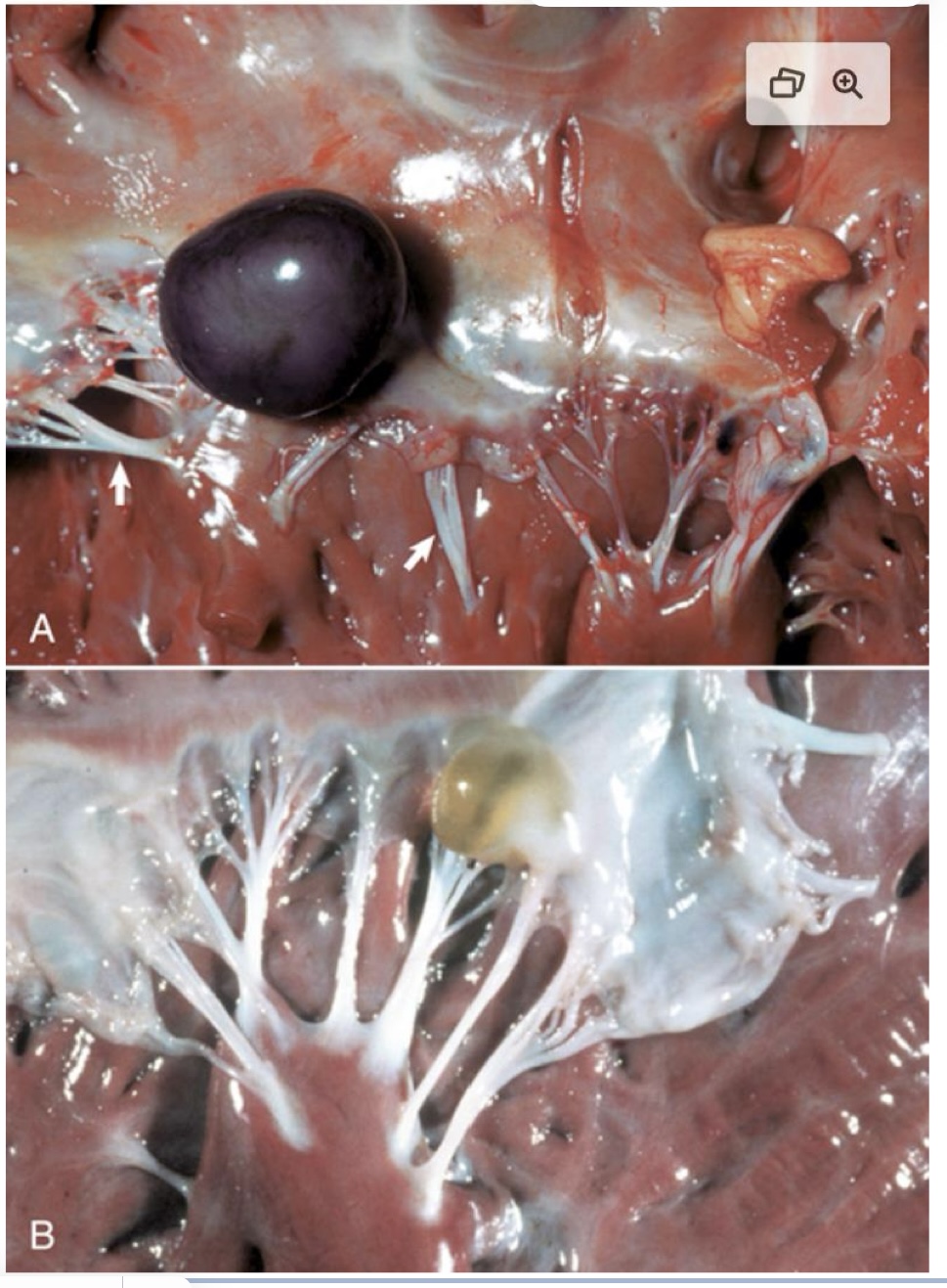 <p>what are these pictures showing?</p>