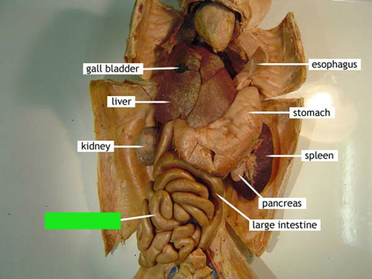 <p>Identify the structure at the green pointer box.</p>