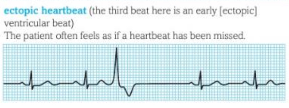 <p>What does this trace show ? </p>