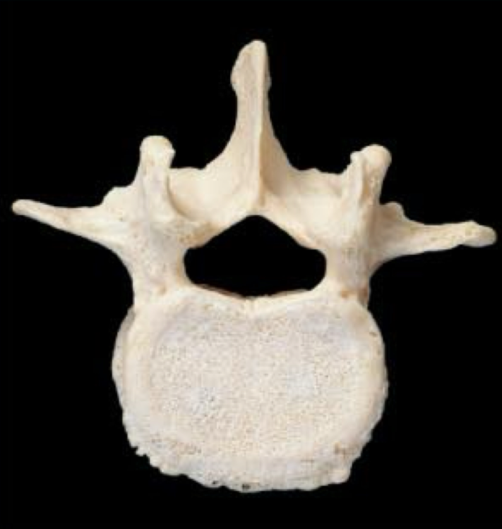 <p>What Vertebrae is this?</p>