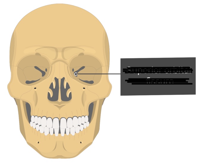 <p>narrow, slit like opening</p>