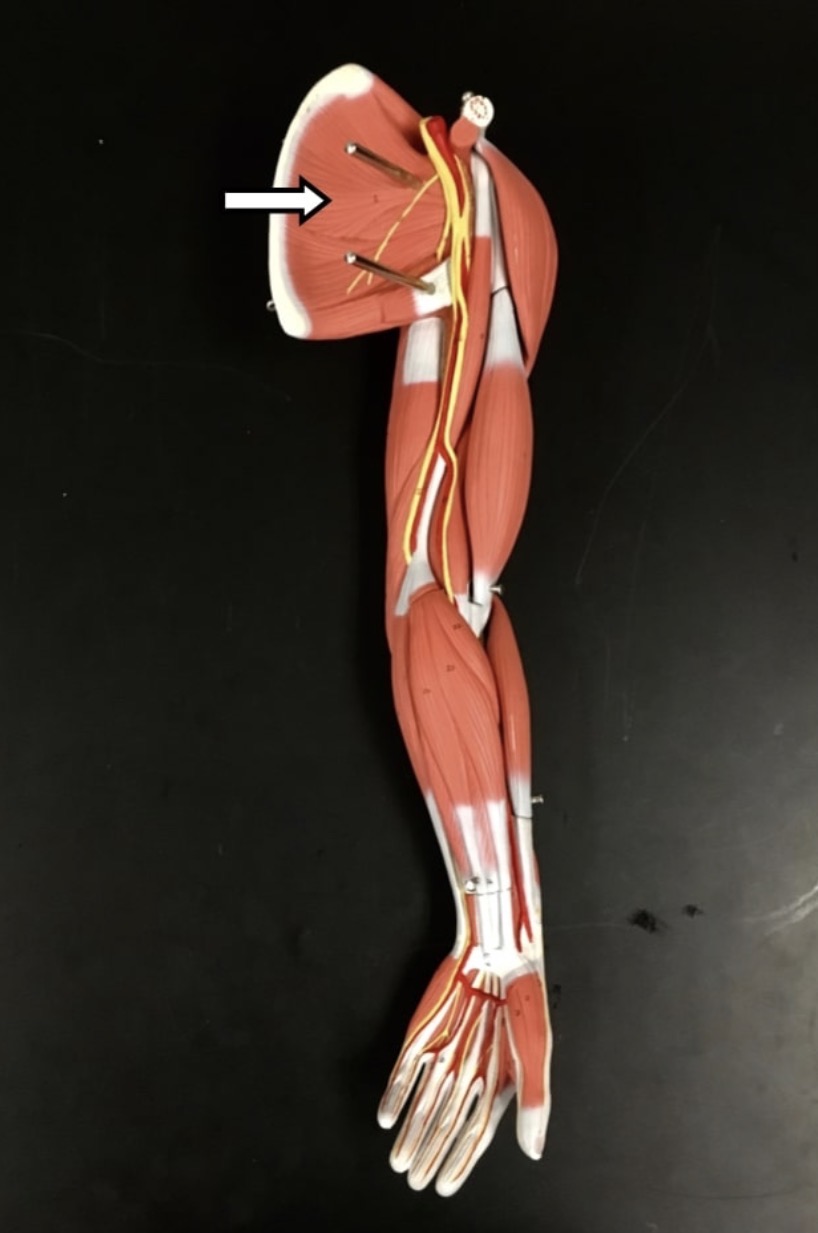 <p><span>Name the muscle labeled with the white arrow below AND name the origin</span></p>