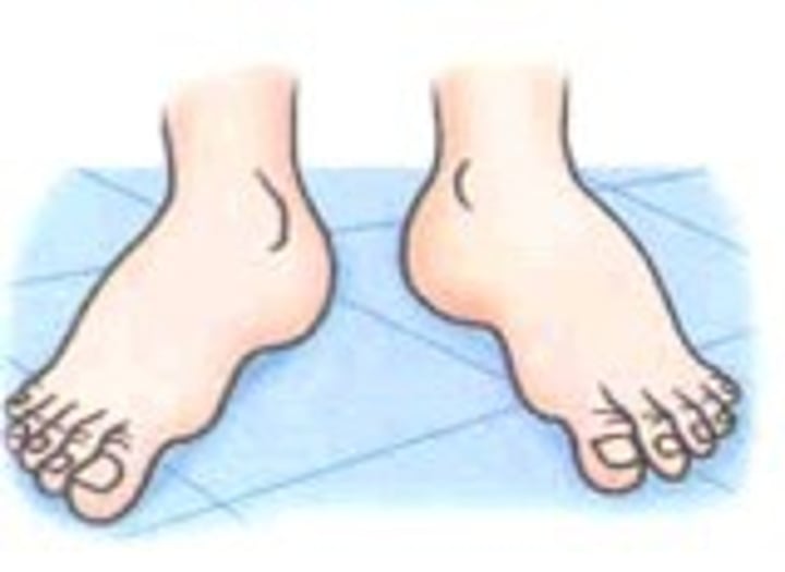 <p>feet</p>