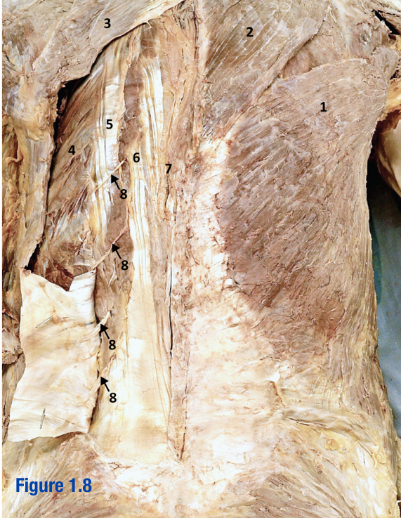 <p>Most medial of 3 erector spinae muscles (next to vertebral column) - Include number in diagram</p>