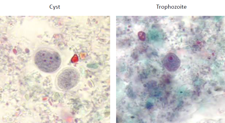 <p>Cyst</p><ul><li><p>Spherical with 4 nuclei</p></li><li><p>lacks chromatin bodies</p></li><li><p>5-10 micron</p></li></ul><p>Trophozoite</p><ul><li><p>single nucleus</p></li><li><p>irregular karyosome</p></li><li><p>highly vacuolated</p></li><li><p>6-12 micron</p></li></ul><p></p>