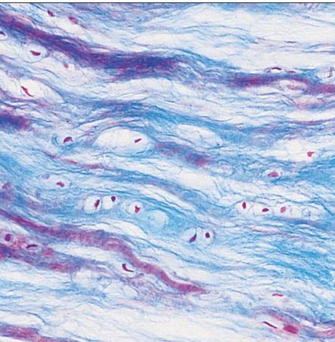 <p>Fibrocartilage </p>