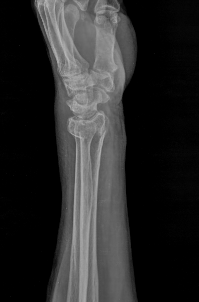 <p>Describe the abnormality demonstrated.</p>