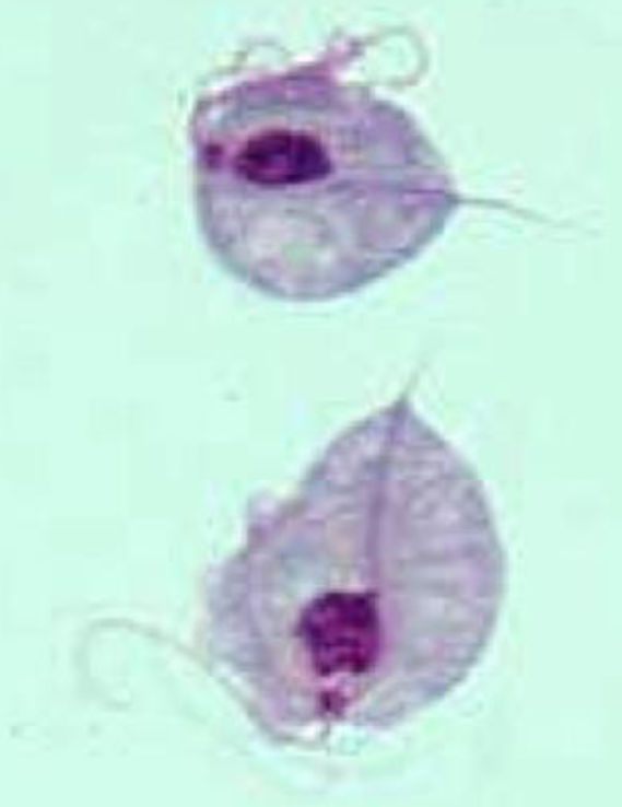 <ul><li><p>most common nonviral STI</p></li><li><p>infects squamous epithelium</p></li><li><p><span style="font-size: calc(var(--scale-factor)*26.27px)">It is pear- or round-shaped with 4 anterior flagella and an undulating membrane that causes characteristic motility seen on wet-mount slide of </span><span style="font-size: calc(var(--scale-factor)*26.30px)">vaginal sections</span></p></li></ul><p></p>