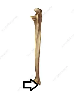 <p>what part of the ulna is this?</p>