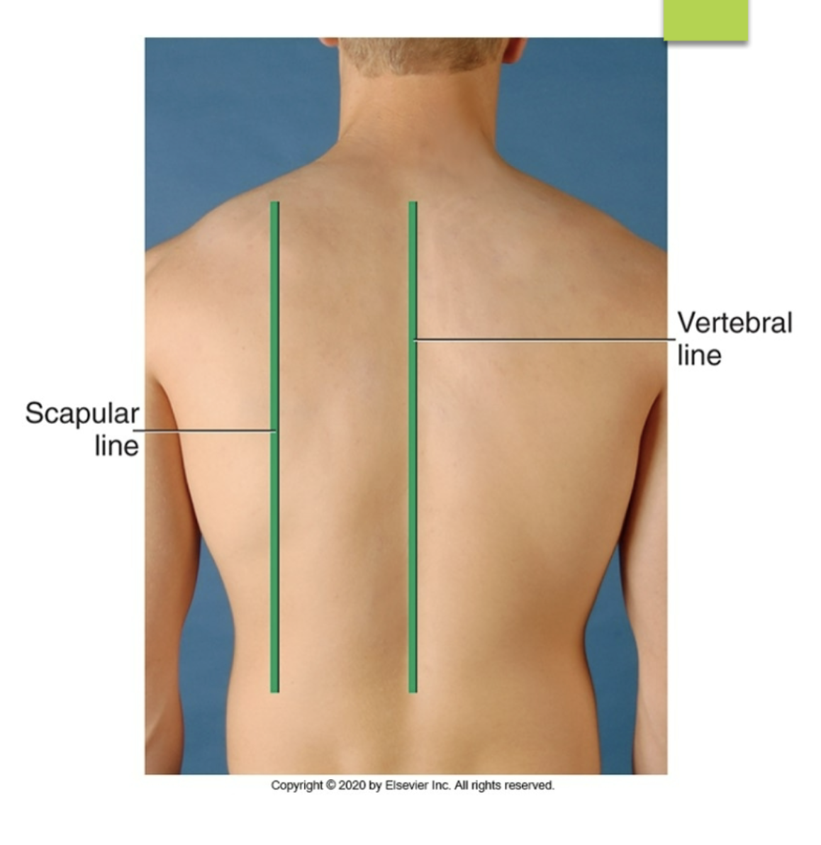 <p>posterior reference line running down the spine</p>