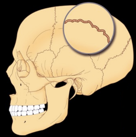 <p>What type of suture</p>
