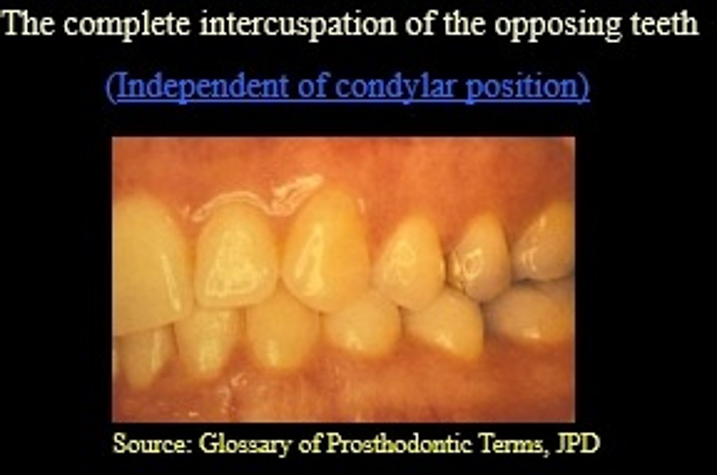 <p>mandible with the teeth are brought into full interdigitation wiht the maximum number of teeth contacting</p>