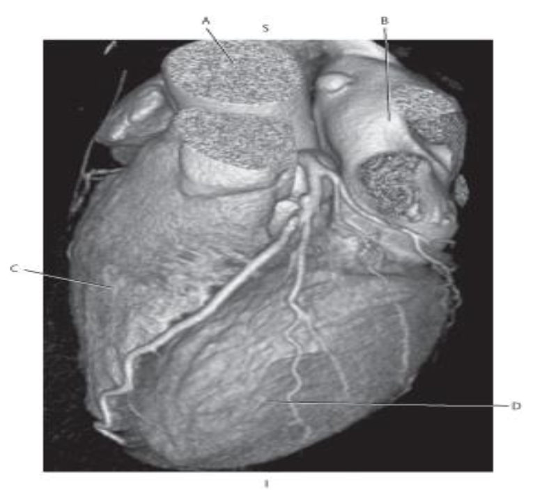 <p>Which line points to the <mark data-color="green">left ventricle?</mark></p>