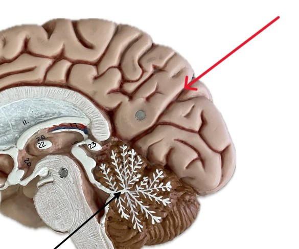 <p>Which part of the brain is:</p><ul><li><p>Deep groove divides parietal and occipital lobe</p></li></ul><p></p>
