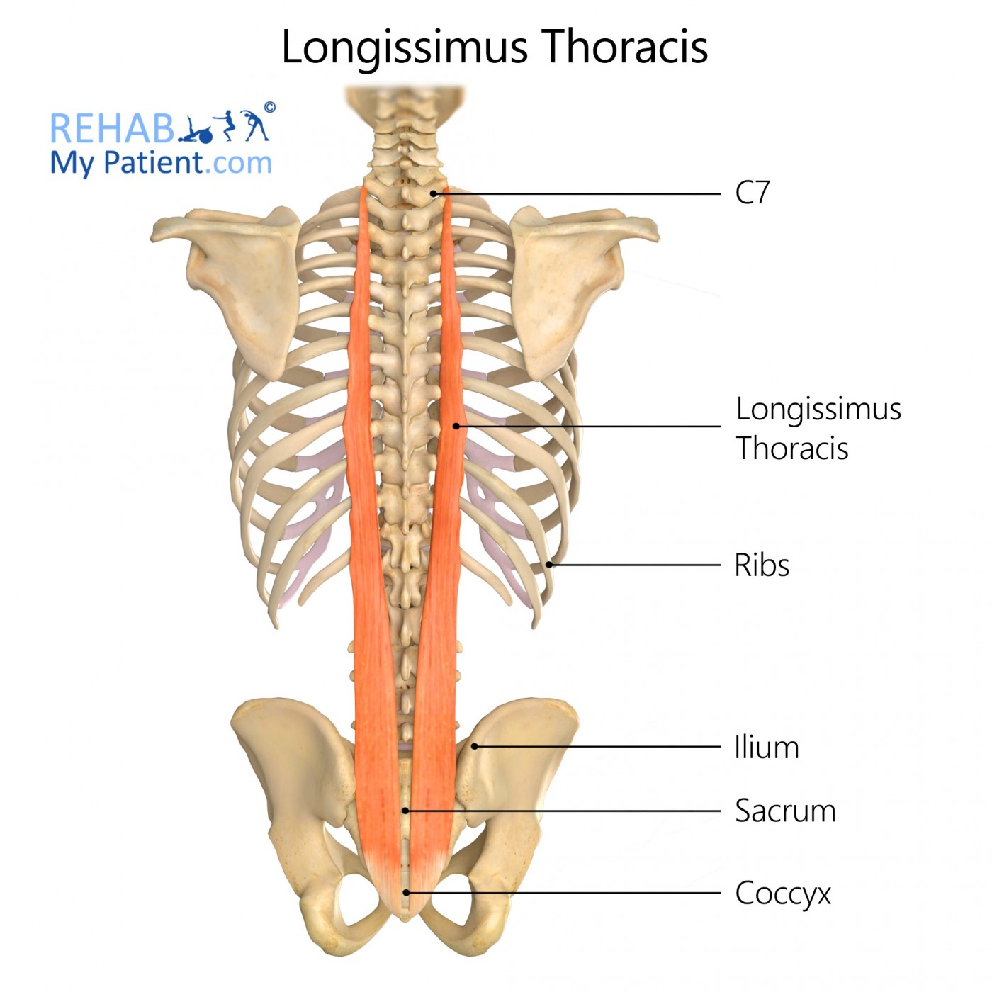 <p><strong>Proximal Attachment</strong></p><p><span>L1-L5 accessory processes</span></p><p><strong>Distal Attachment</strong></p><p><span>Ventral surface PSIS; L1-L4 caudal tendons form lumbar intermuscular aponeurosis</span></p><p><strong>Peripheral Innervation</strong></p><p>Posterior rami of spinal nerves</p><p><strong>Action</strong></p><p><span>Back extension, creates posterior shear forces to counteract anterior shear forces</span></p>