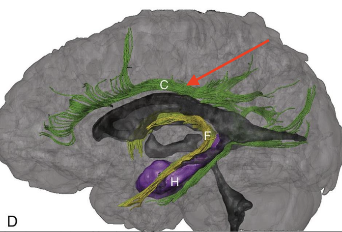 <p>course parallels cingulate/parahippocampal gyri</p>