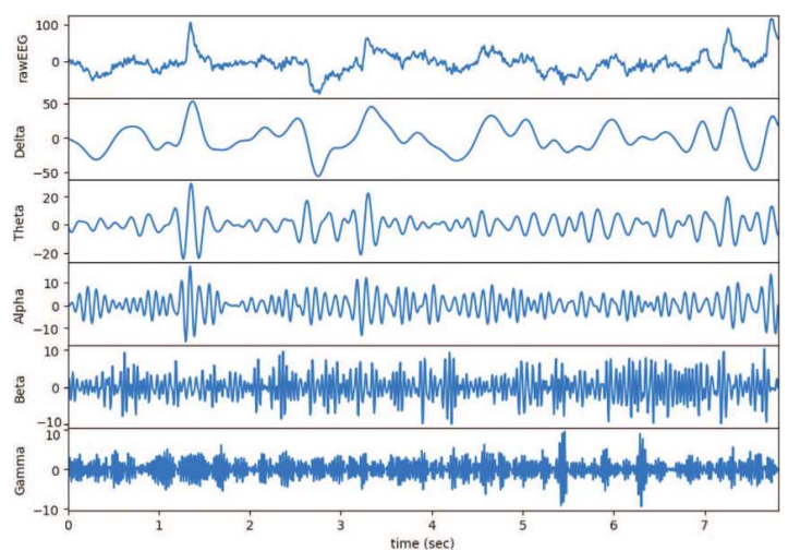 <ul><li><p>Signals from medical instruments can be complex (e.g., ECG/EEG)</p></li><li><p>Larger signal complexity leads to larger computer file sizes</p></li></ul><p></p>