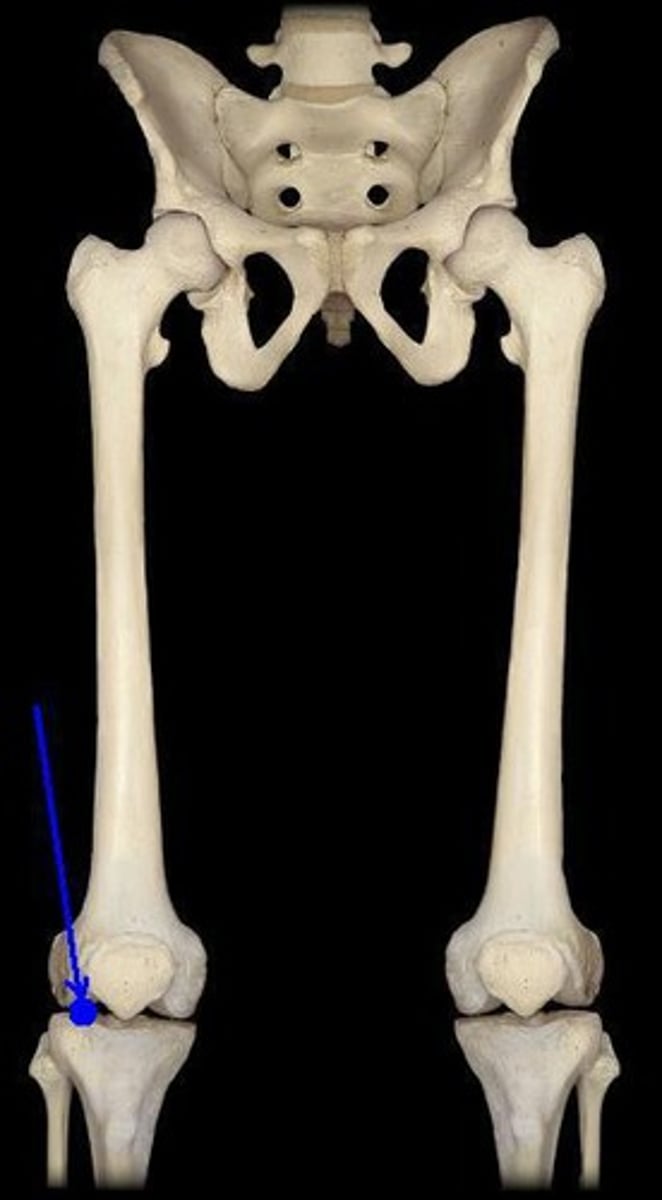 <p>knee joint</p>