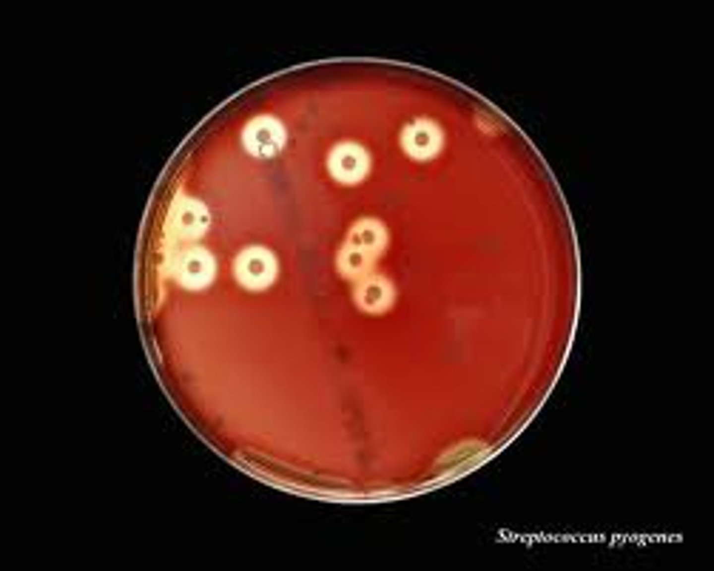 <p>The zone around colony growth is a clear halo; complete hemolysis; Staphylococcus areus or Streptococcus pyogenes</p>