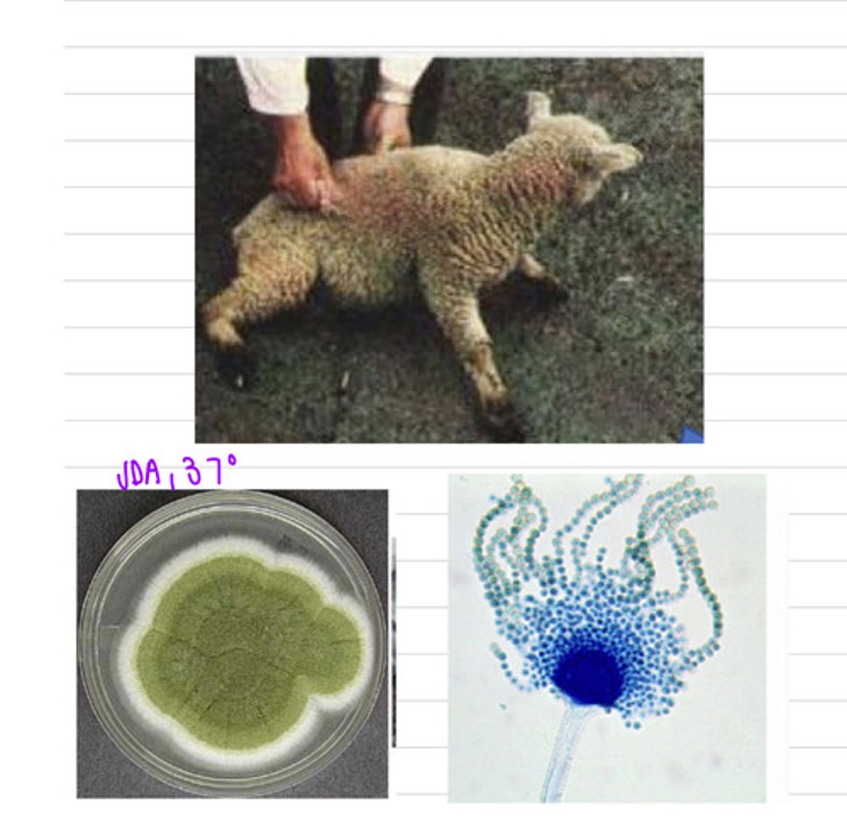 <p>a sheep beings to have neurological signs, such as muscle tremors, rigidity, seizures, recumbency, and fainting. we take a sample and isolate it on SDA at 37 degrees and see these results.</p><p>what is the diagnosis?</p>