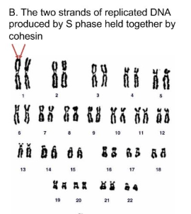 <p>The two strands of replicated DNA produced by S phase held together by cohesin </p>