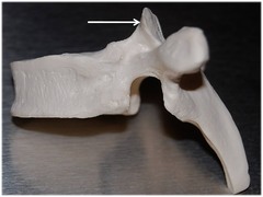 Name this specific part of the thoracic vertebra.