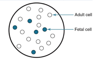 <ul><li><p>Flow cytometry or Kleihauer-Betke test quantifies fetomaternal hemorrhage for additional RhIG doses.</p></li><li><p>Kleihauer-Betke test: </p><ul><li><p>Fetal hemoglobin resists acid (retains dye)</p></li><li><p>adult hemoglobin does not (ghost-like).</p></li></ul></li></ul><p></p>