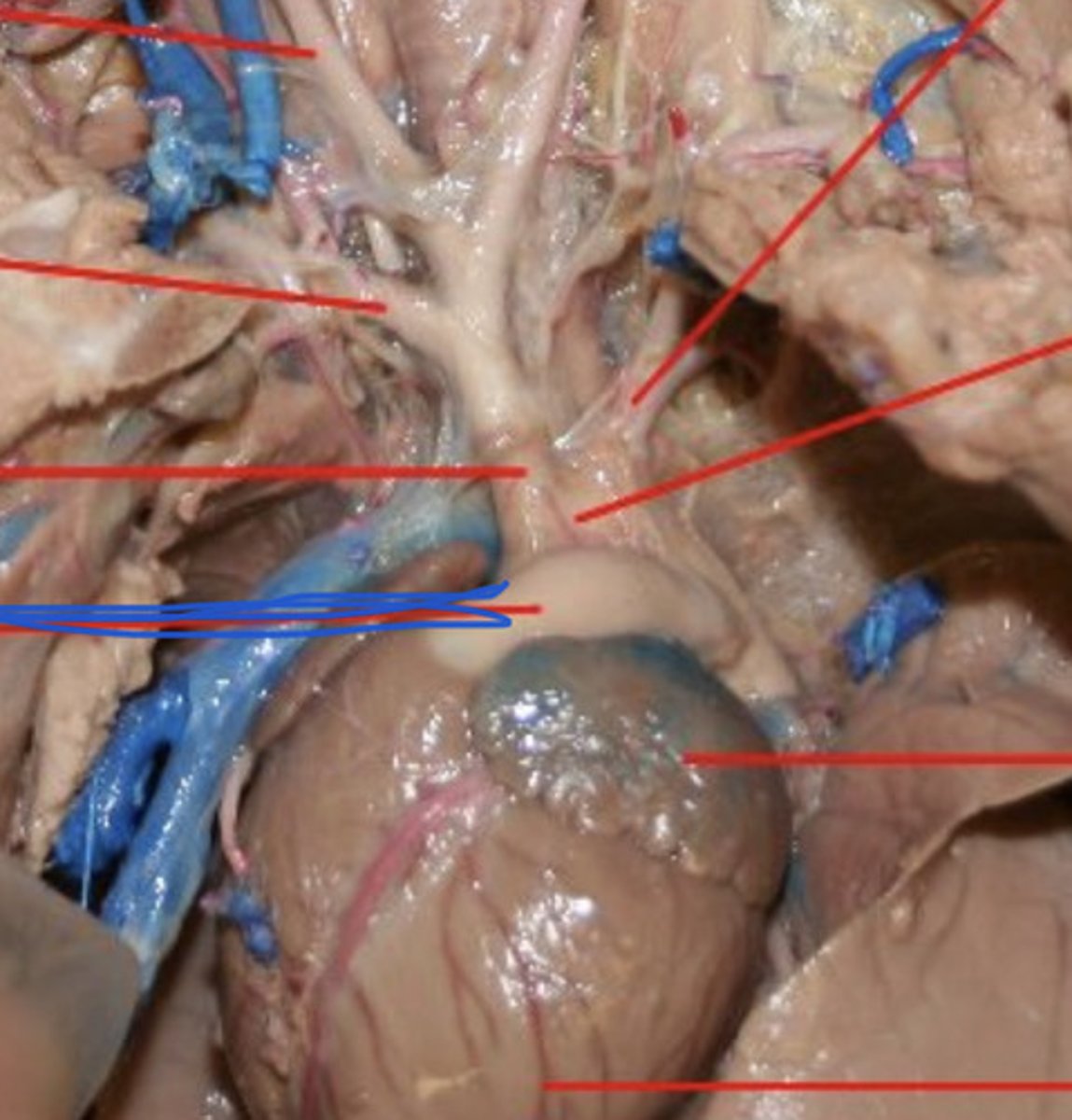 <p>carries blood from right ventricle to pulmonary arteries</p>