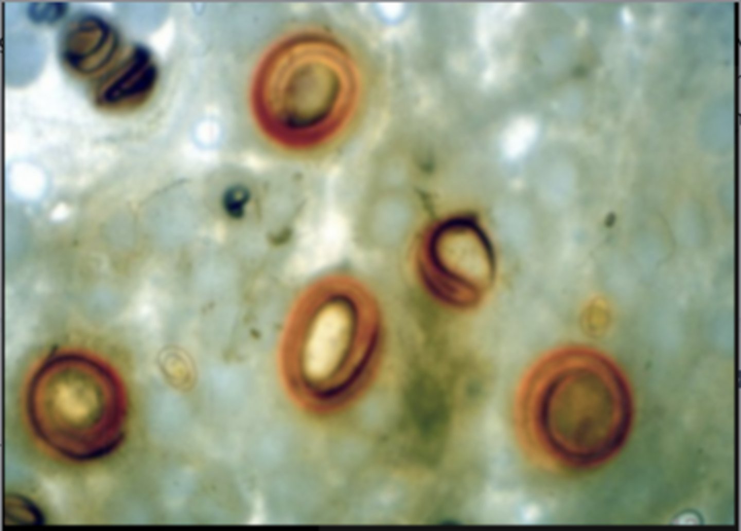 <p>How does this worm cause desease?</p>