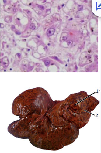 <p>Adenovirus infection</p><ul><li><p>Intranuclear dark marginal bodies</p></li><li><p>Widespread haemorrhage</p><ul><li><p>Virus has tropism for endothelium</p></li></ul></li><li><p>Enlarged, reddened lymph nodes and tonsils</p></li><li><p>Recovering animals - immune mediated uveitis + corneal opacity</p></li></ul><p></p>