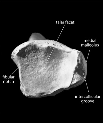 <p>on tip of medial malleolus</p>