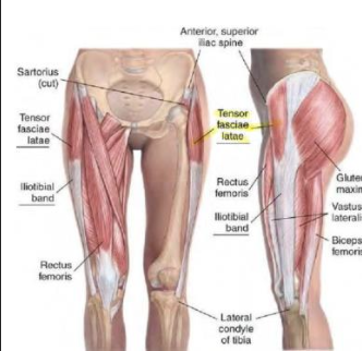 <p>TFL - Flexor</p><p>N</p>