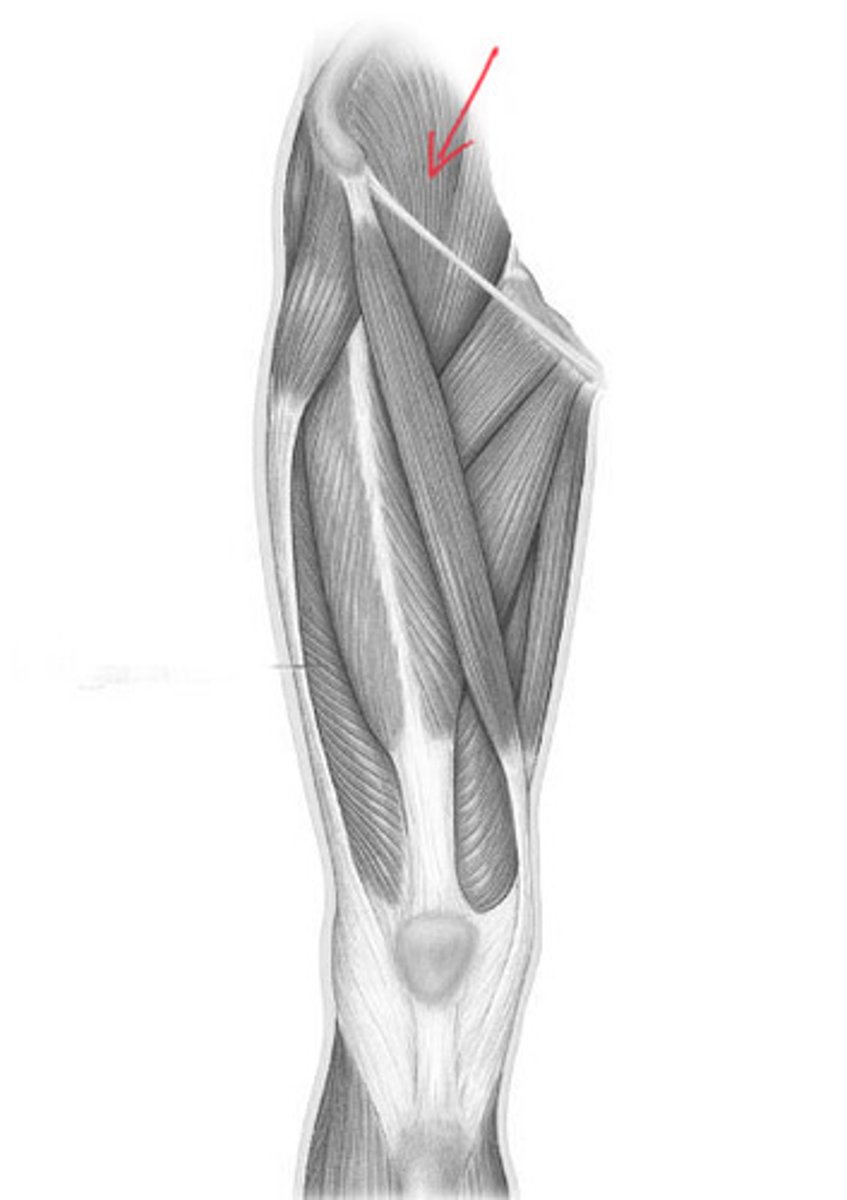 <p>Name the muscle</p>