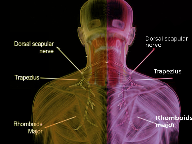 <p>If the right dorsal scapular nerve was cut near its origin, what would result:</p><p>A. Skin of the upper back on the right side would be numb</p><p>B. The point of the right shoulder would droop</p><p><strong><mark data-color="red" style="background-color: red; color: inherit">C. Scapular retraction on the right would be weakened</mark></strong></p><ul><li><p><strong>right dorsal scapular nerve → </strong>rhomboid major and minor muscles + levator scapulae</p><ul><li><p>responsible for movements like:</p><ul><li><p><strong>scapular retraction</strong> (pulling the shoulder blades together)</p></li><li><p><strong>elevation</strong> of the scapula</p></li></ul></li></ul></li></ul><p>D. Extension of the right arm would be weakened</p><p>E. Inability to adduct the right arm</p>