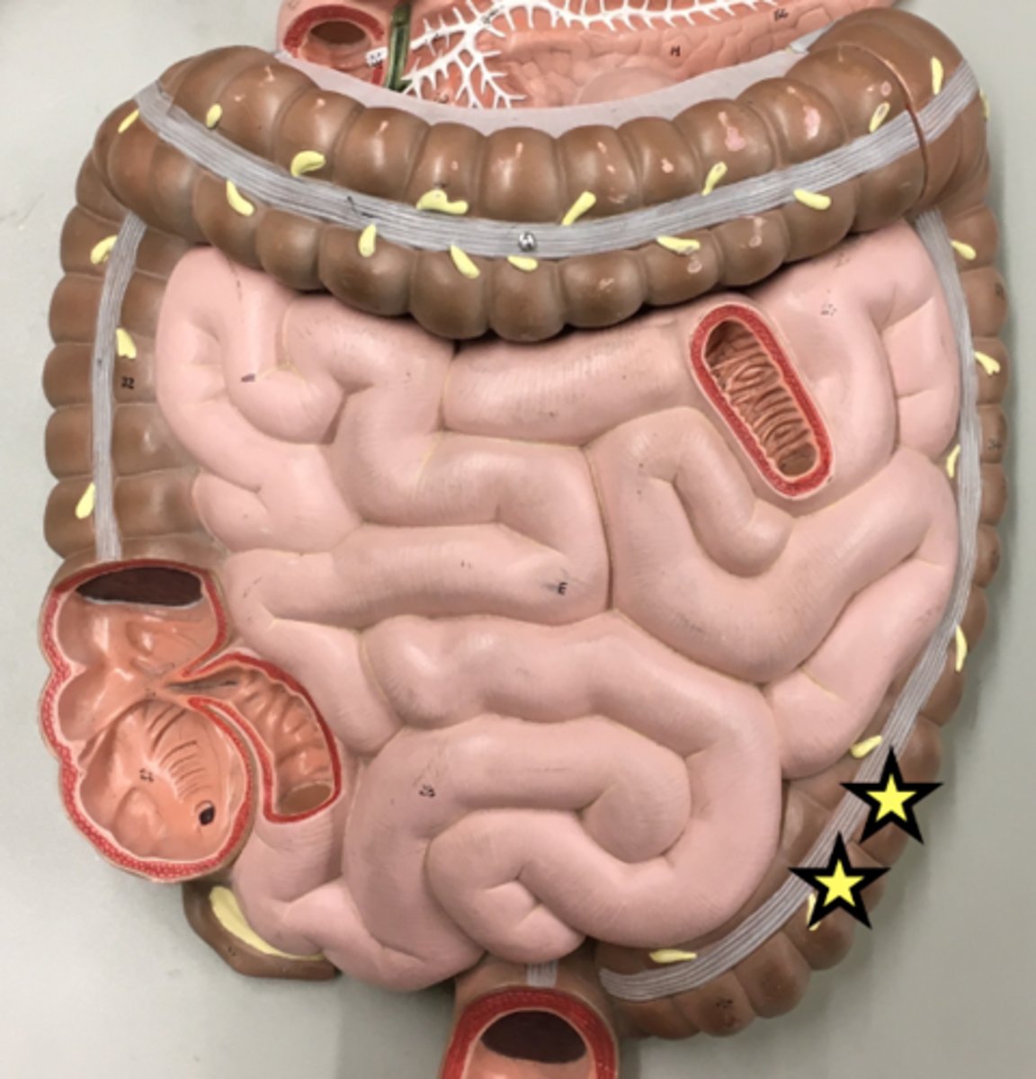 <p>Name this curvature (or turn)</p>