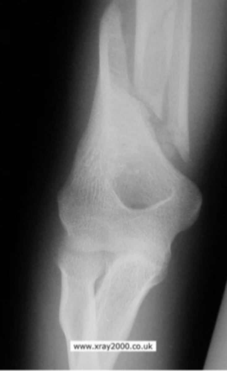 <p>What is the issue?</p>