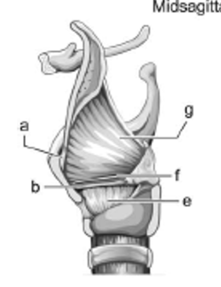 <p>label e - is it extrinsic or intrinsic?</p>
