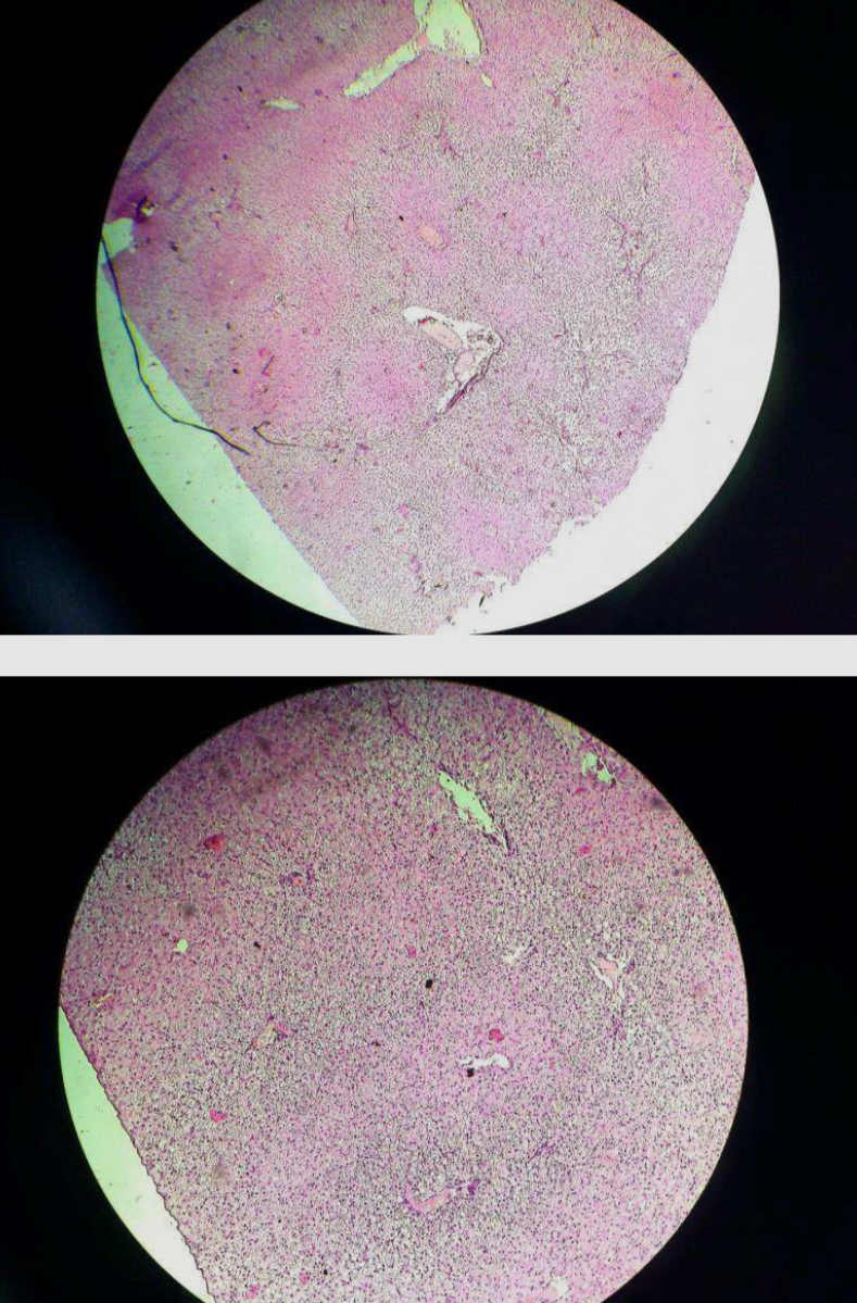 <p>Liver </p>