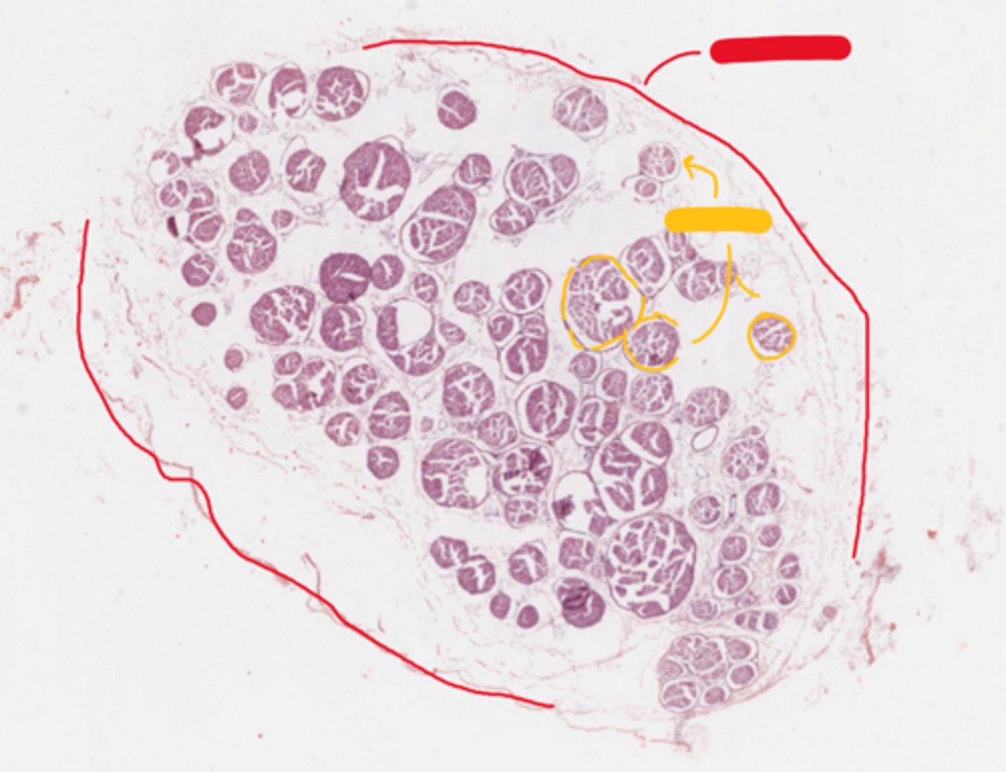 <p>red</p><p>(nerve in cross section)</p>