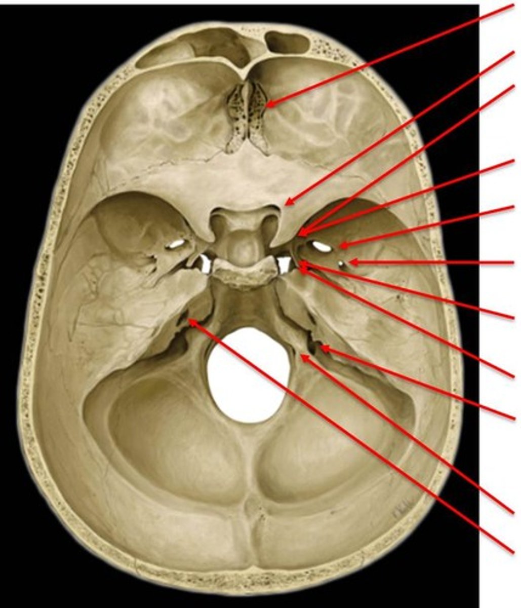 <p>floor of the neurocranium</p>