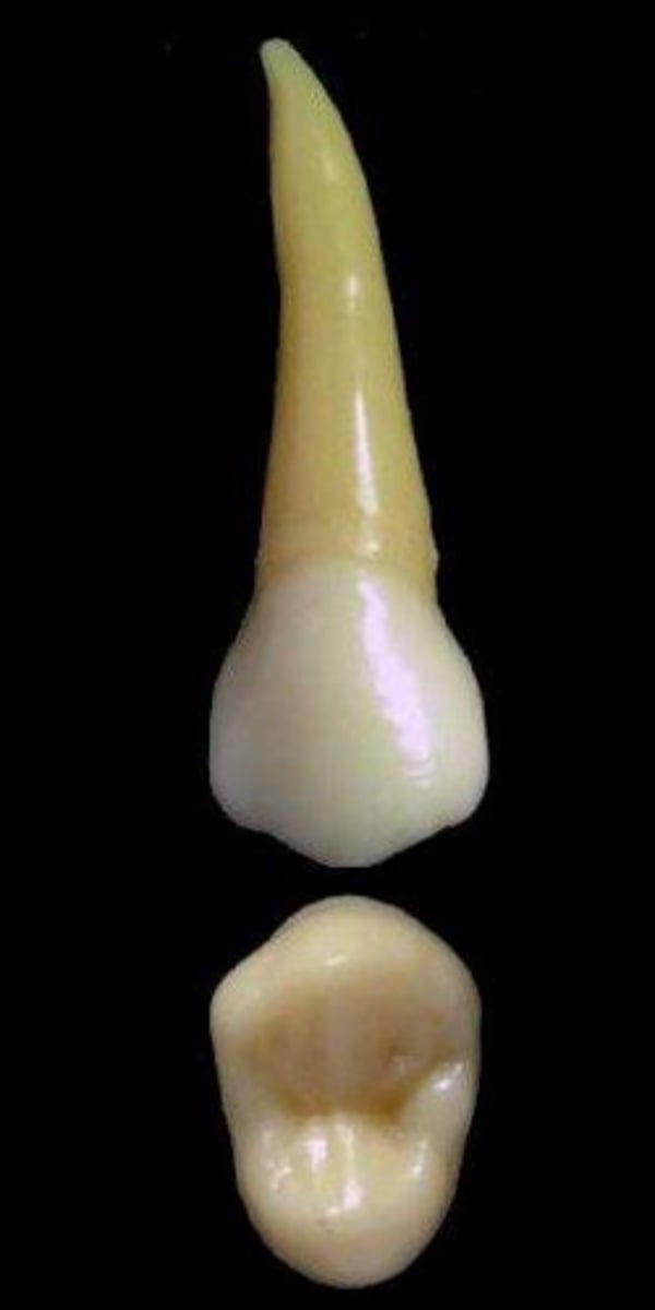 <p>what tooth is this &amp; why?</p>