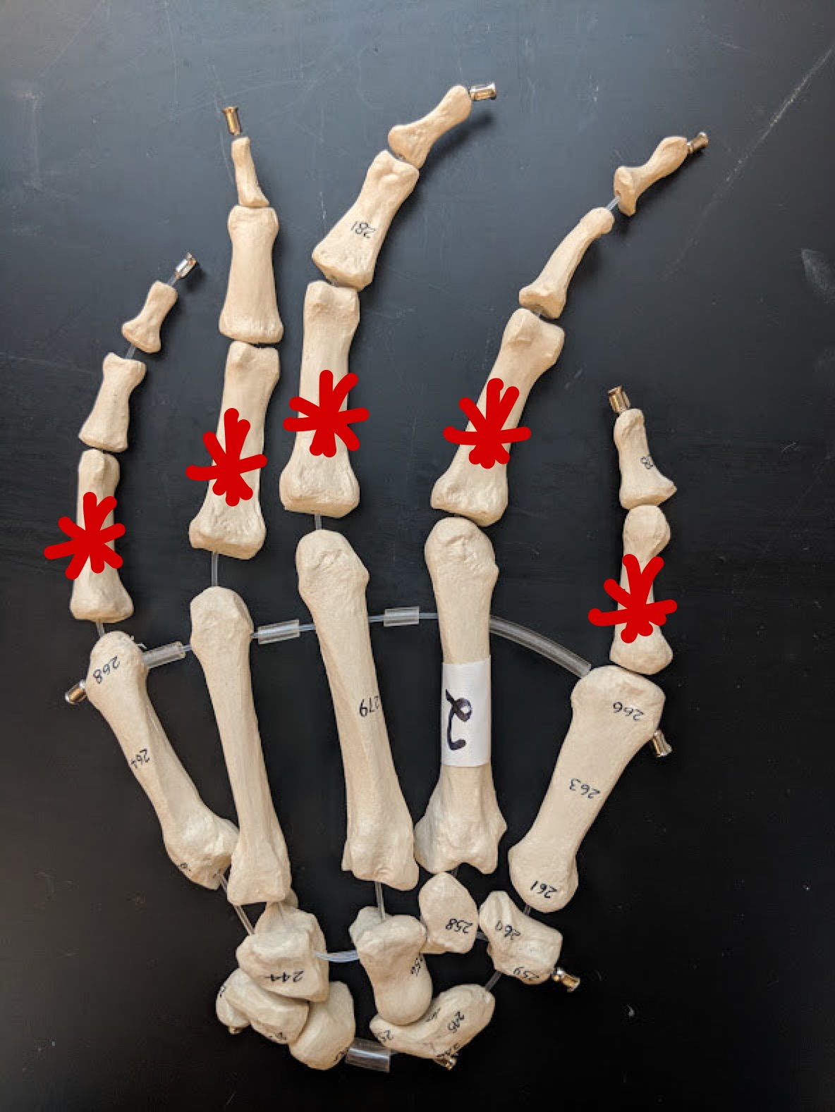 <p>Name these bones</p>