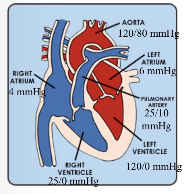<p>How to calculate RV pressure in pul stenosis </p>