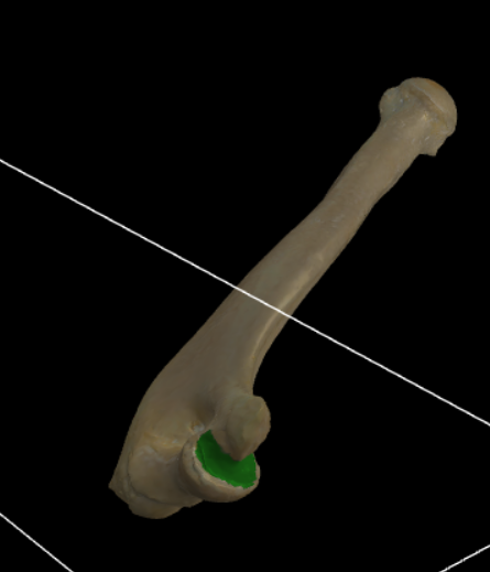 <p>Goot op de dorsale zijde van de epicondylus medialis.</p>