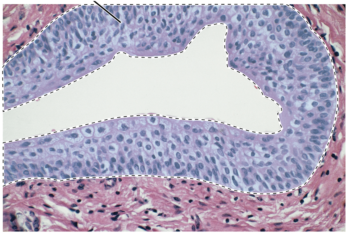 <p>Name the highlighted tissue.</p>