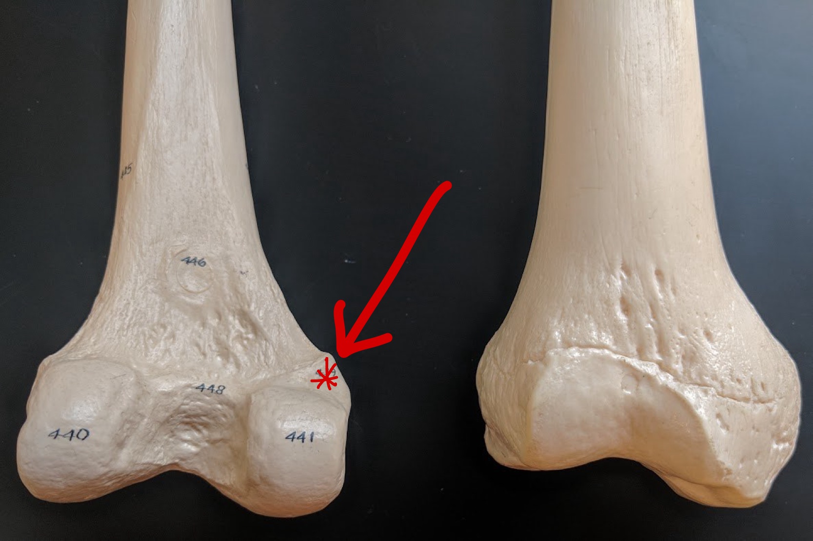 <p>Name this structure</p>