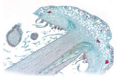 <p>Vad kollar du på, och från vilket fylum? Vad är funktionen av det du kollar på? Peka ut arkegon, halskanal och äggcell</p>