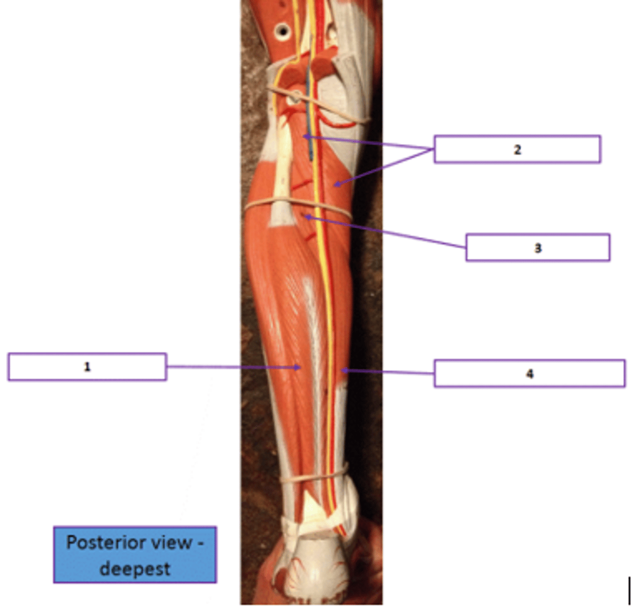 <p>Identify the muscle labeled 4.</p>