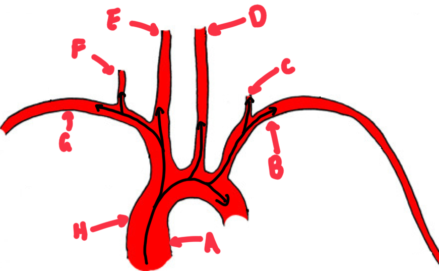 <p>Name these major arteries from the heart. </p>